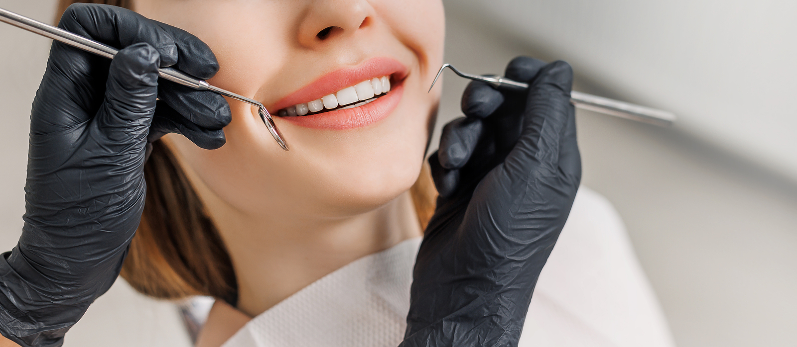 The Benefits of Choosing Dental Veneers for Your Smile