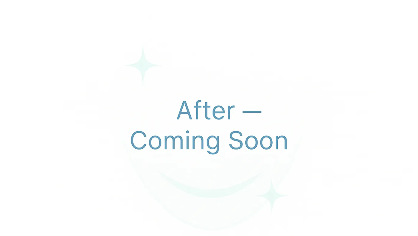 After — upper arch rehab